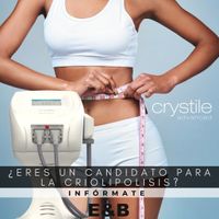 criolipolisis